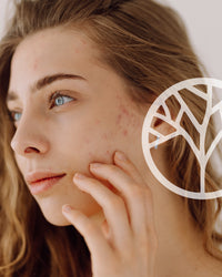 Programme imperfections & hydratation