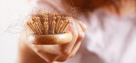 Comment aider à stopper la chute des cheveux ?