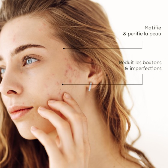 Routine imperfections