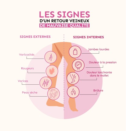 les signes d'un retour veineux de mauvaise qualité